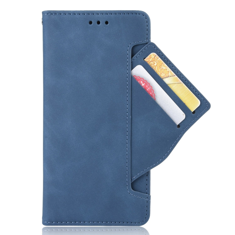 For Ulefone Armor X9 Skin Feel Calf Pattern Leather Phone Case(Blue) - Ulefone Cases by buy2fix | Online Shopping UK | buy2fix