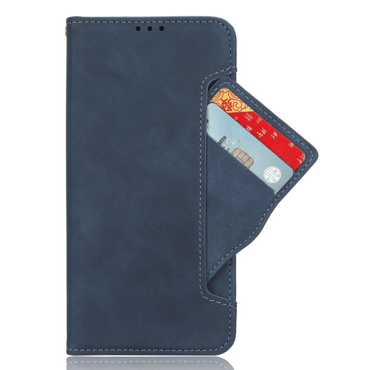 For Doogee X97 / X97 Pro Skin Feel Calf Texture Card Slots Leather Phone Case(Blue) - Doogee Cases by buy2fix | Online Shopping UK | buy2fix